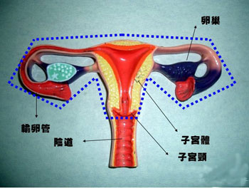 子宫肌瘤形成的原因有哪些